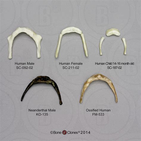 Set Of 5 Human Hyoids Bone Clones Inc Osteological Reproductions