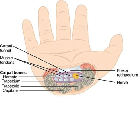 Carpal Tunnel Syndrome Musculoskeletal Physiotherapy Australia