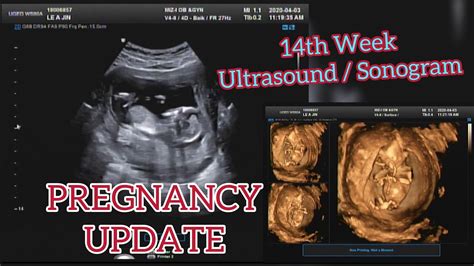 14th Week Ultrasound Sonogram Pregnancy Update ️the Higginses Youtube