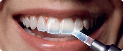Tooth Enamel And Dental Care Dr Nechupadam Dental Clinic