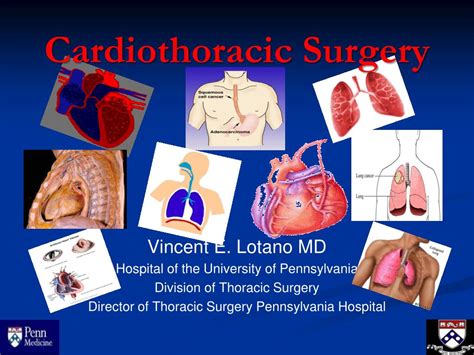 Ppt Cardiothoracic Surgery Powerpoint Presentation Free Download Id2249302