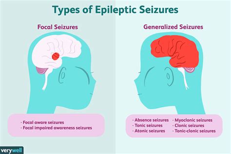 Epilepsie Symptome