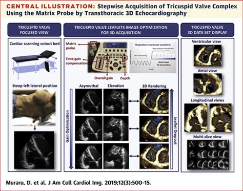 3 Dimensional Echocardiography In Imaging The Tricuspid Valve Jacc