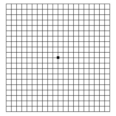 Macular Degeneration Test North Queenland Eye Clinic