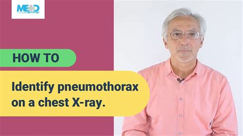 How To Identify Pneumothorax On A Chest X Ray Youtube