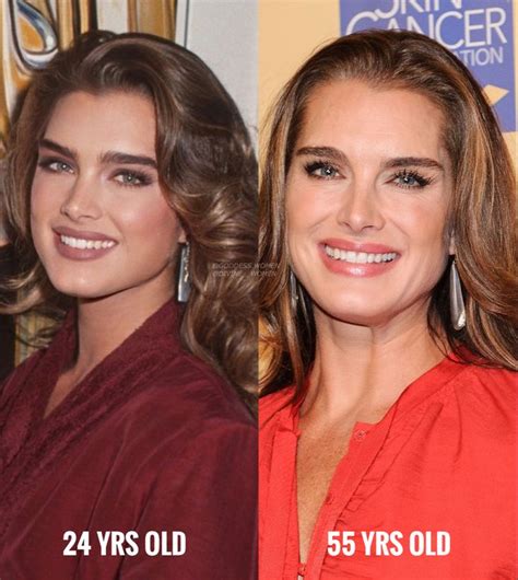 Brooke Shields Beauty Standards Celebrities Before And After Beauty
