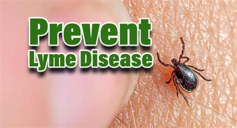 Preventing Tick Bites And Lyme Disease Mega Doctor News