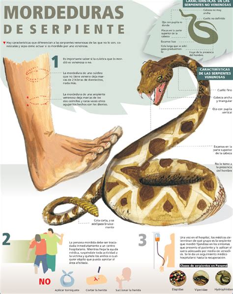Mordeduras De Serpientes En España M Estefanía Díez 2014 Med Tac