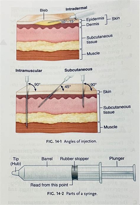 1st Diagram Is An Intradermal Injection Angle Of Insertion Is 10 15 Degrees Goes Into The
