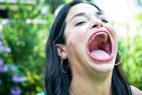 Woman With World S Largest Mouth Wins Guinness World Record For Cm Gob Redcelebrities Com
