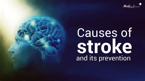 Causes Of Stroke And Its Prevention Medonlinepk