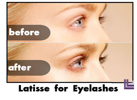 Check spelling or type a new query. Latisse Eyelash and Eyebrow Enhancers | St. Louis Cosmetic ...