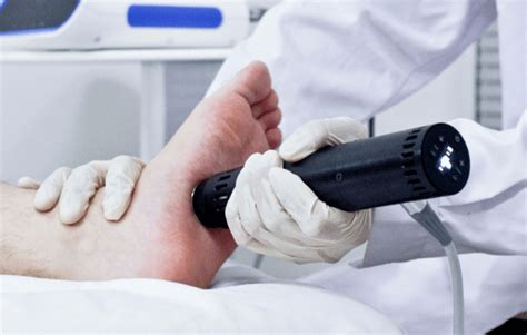 Can Shockwave Therapy Help Plantar Fasciitis Ask Dr P The Pain Doc