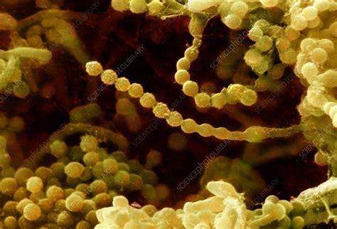 Mrsa Bacteria Sem Stock Image C Science Photo Library My Xxx Hot Girl