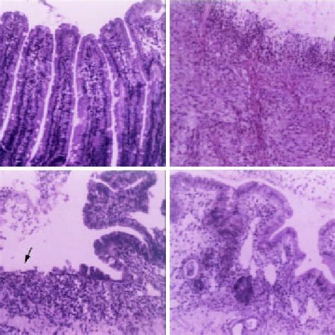 Representative Micrographs Of Duodenal Mucosa Stained By Haematoxylin