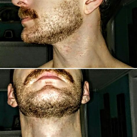 Make Sure You Never Shave To High When Growing Your Beard I Like To
