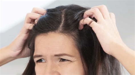 What Causes Itchy Bumps On Scalp And How You Can Get Rid Of Them