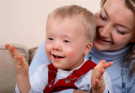 What Is Mosaic Down Syndrome With Pictures