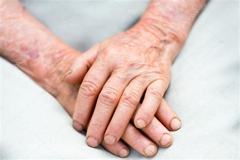 Elderly Hands Stock Photo By ©lighthunter 25178733