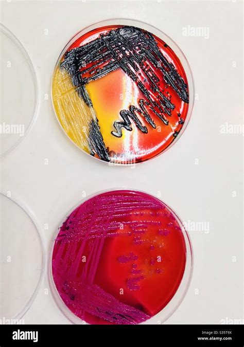 Xld Agar Is Used To Differentiate Salmonella Species From Shigella