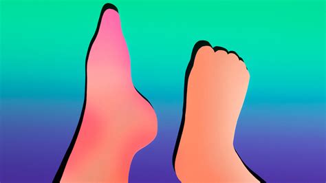 Her Foot Looked Normal. What Was Causing the Excruciating Pain? - The