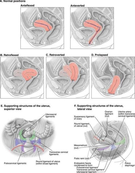 positions of the uterus obstetric ultrasound ultrasound sonography ultrasound school