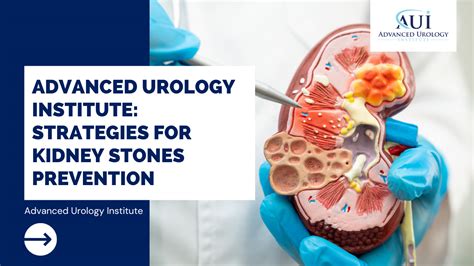 Advanced Urology Institute Strategies For Kidney Stones Prevention