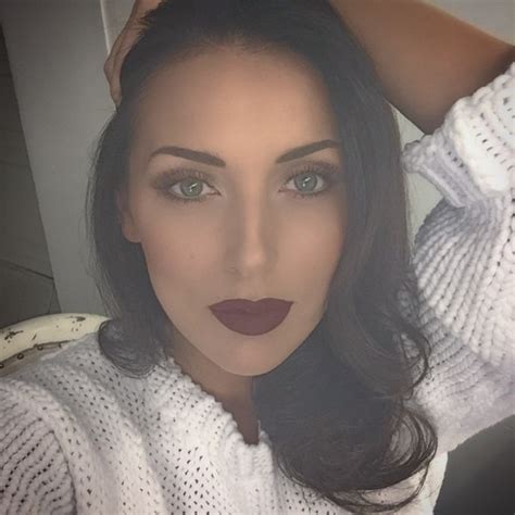 Singer Alsou Shocked With Overinflated Lips Photo