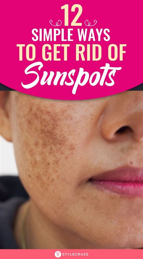 12 Simple Ways To Get Rid Of Sunspots In 2020 Sun Spots On Skin