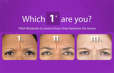 Botox For Frown Lines Premier Image