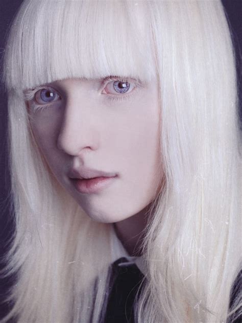 Nastya Kumarova Albino Beauty Portrait Photography Albino Model Albinism Beauty