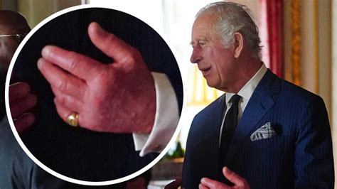 Photos Of King Charles Fingers Raise Eyebrows Trendradars New Zealand