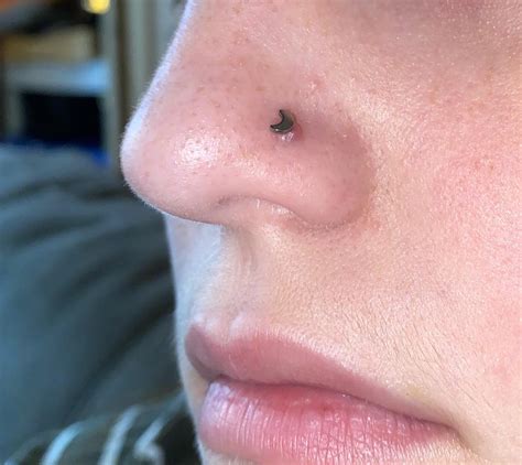 Keloid Or Irritation Bump I Got My Nostril Pierced About 6 Weeks Ago I Clean It Twice A Day