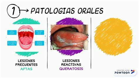 Patologias Orales Youtube