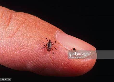 Lyme Disease Symptoms Photos And Premium High Res Pictures Getty Images