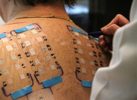But how the sample is collected, what the lab tests for, and how the results are delivered can make all the difference when picking your test. New Blood Test Finds Allergies BEFORE Implant Surgery ...