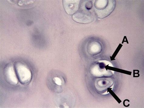Hyaline Cartilage A Edge Of The Lacuna B Nucleus Of A Chondrocyte