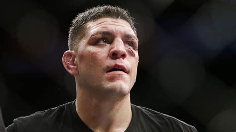 Silva didn't do a ton of damage, but nick did none. Nick Diaz's epic taunting of Anderson Silva : sports