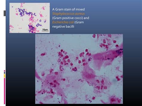 Common Investigations In Dermatology