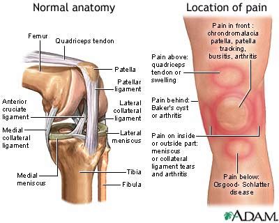 However, adhesions to surrounding tissue will prevent tendon gliding necessary to allow active flexion once the tendon has healed. The Blonde Mule: Knee Pain - Ouch!
