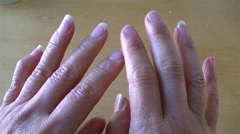 A critical look into skin peeling on fingers, near nails, fingertips, hands, causes and treatments. Battling winter dry hands, skin peeling, and cracked ...