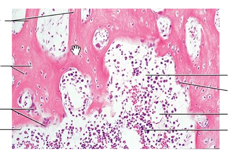 Cancellous Bone Sternum Decalcified Bone Transverse Section Diagram