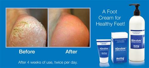 Before And After Hydrasole Hydrating Foot Cream Foot Cream Moisturizer Hand Soap Bottle