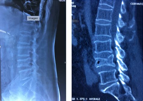 Simple Science: How to Make a Volcano with Kids