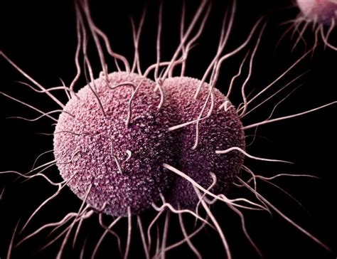 A person who is sexually active should know how the disease and the first signs of infection are transmitted. Gonorrhea (Clap): Symptoms & Signs, Causes, Treatment