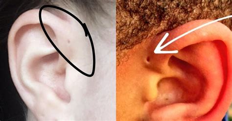 People Are Learning The Tiny Holes Above Their Ears Can Be Explained By