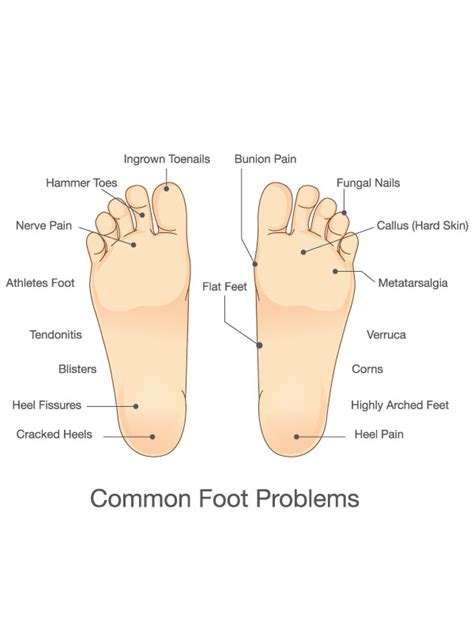 Basic Foot Care Mvs Podiatry Associates