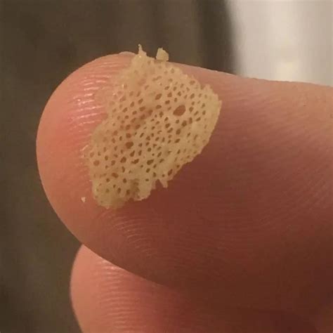 People Are Sharing Their Unexpected Trypophobia Moments And Here Are