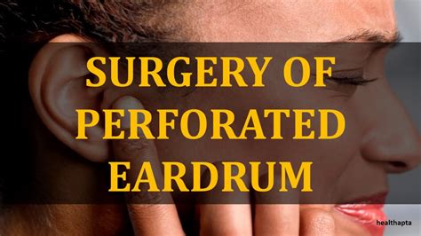 Surgery Of Perforated Eardrum Youtube