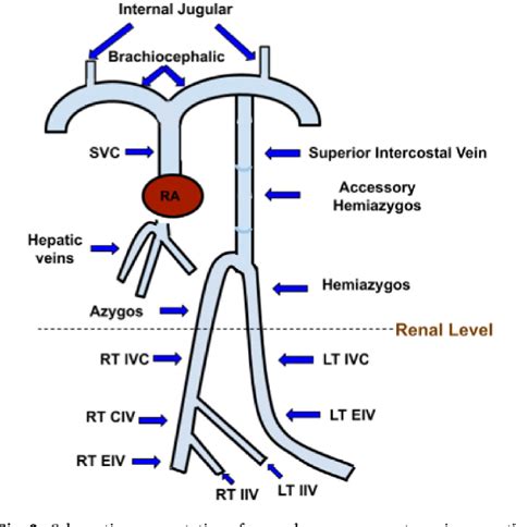 Figure 3 From Interrupted Inferior Vena Cava Syndrome Discovered